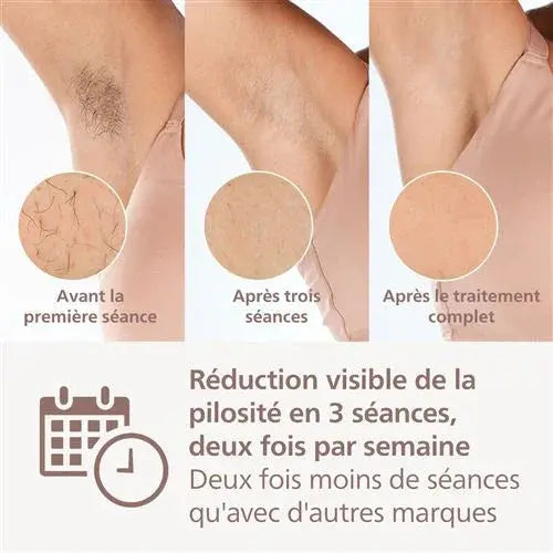 Épilateur à lumière pulsée Philips Lumea série 8000 SenseIQ BRI945 Blanc et Rose - STORE COMMERCE
